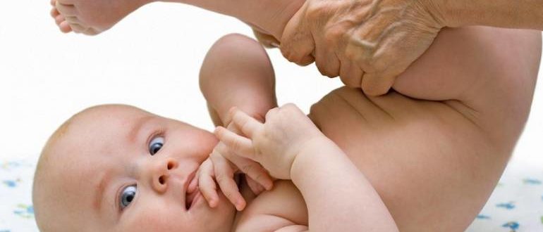 Дисплазия тазобедренных суставов у ребенка