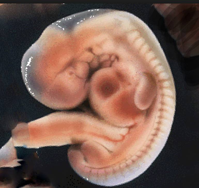 Эмбрион на пятой недели беременности