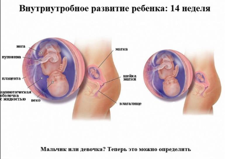 Можно определить пол ребенка в 14 недель беременности