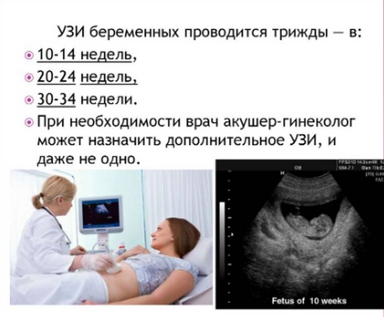 Сколько раз проводят УЗИ при беременности